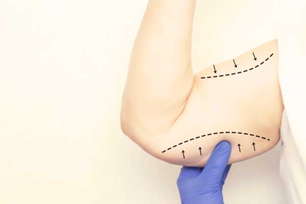 Levantamiento de brazos en Turquía