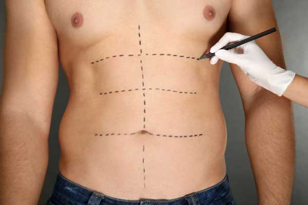 Chirurgie du corps en Turquie