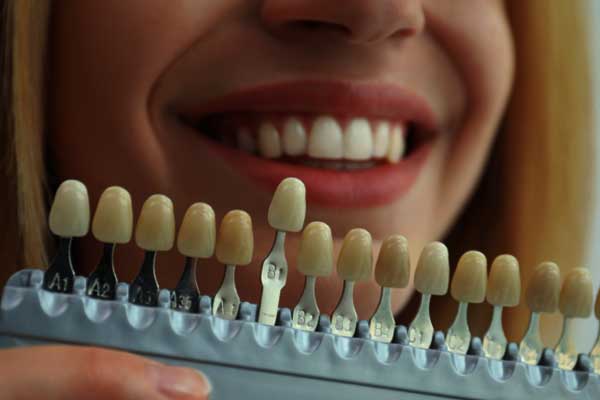 Kosmetische Zahnheilkunde in Türkiye