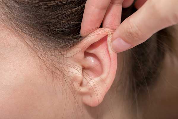 ear pinning without surgery