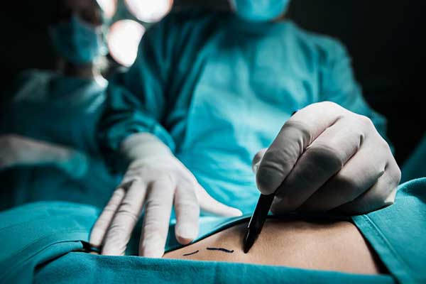 نحت الجسم وشد البطن في تركيا