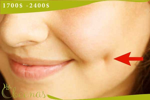 Cheek Dimples in Turkey