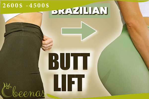 brazilian butt lift turkey