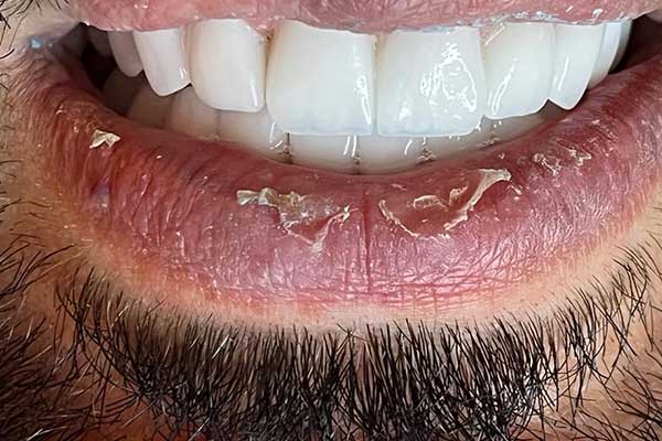 أطباء أسنان في تركيا : الخدمات المتميزة والعناية الشخصية