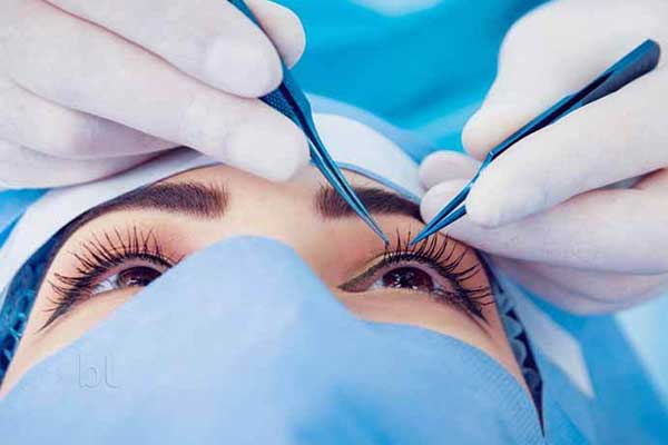 جراحة العيون في تركيا : تقنيات حديثة وأمل في تحسين الرؤية