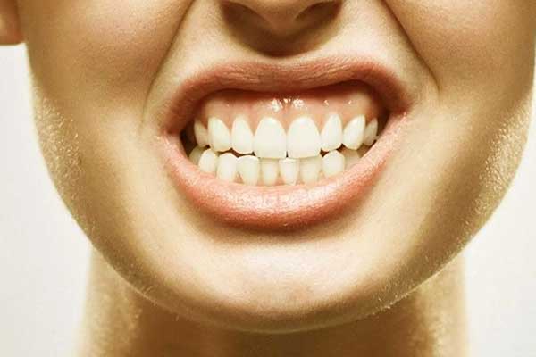 علاج سوء الإطباق الأسنان – دليل شامل لعلاج المشكلة