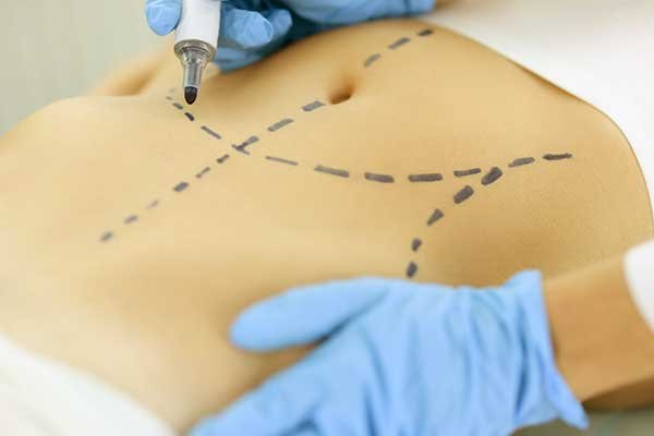 best gastric sleeve surgeon