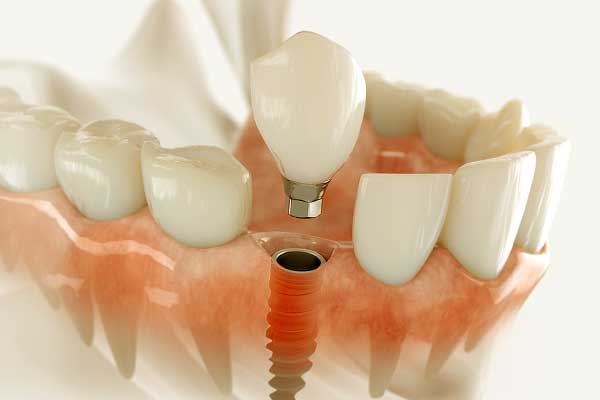 istanbul dental care