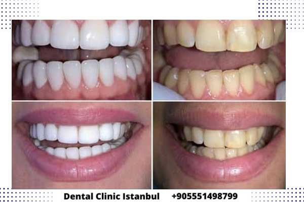 Dental Clinic Istanbul