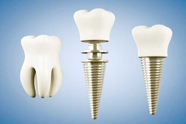 Clínica dental en Turquía Estambul - Turismo Médico