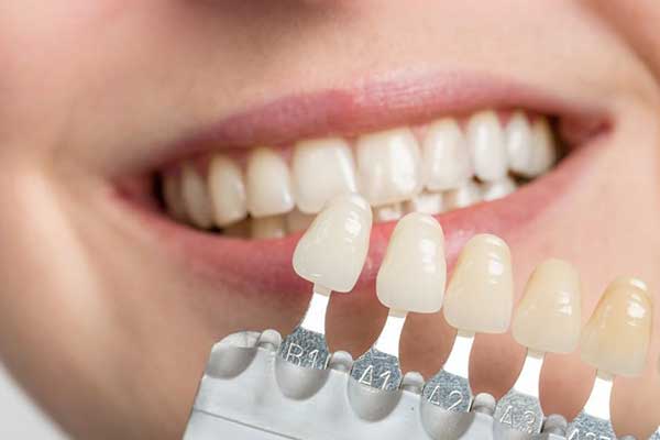 تركيب الاسنان الزيركون