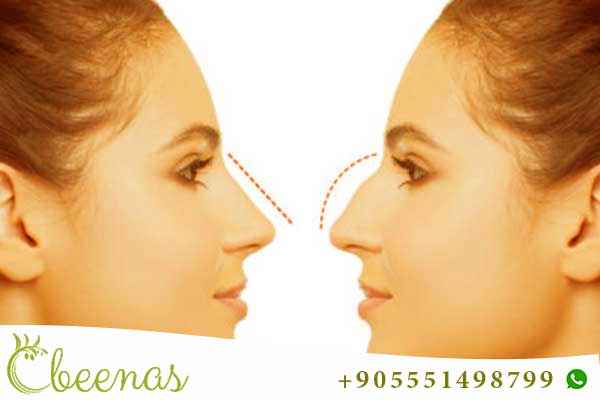 Nose Job Turkey : Enhancing Beauty with Precision