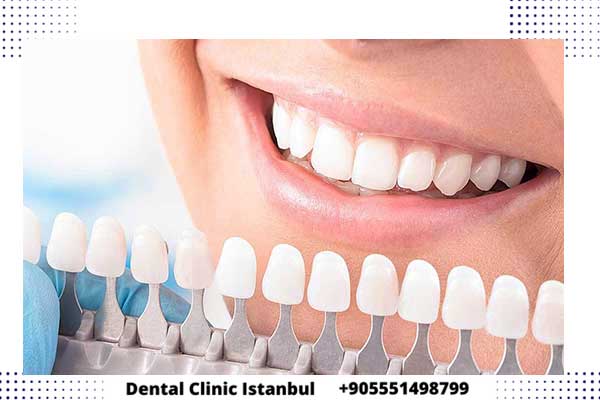 تقنيات علاج الاسنان في تركيا – خيارات متنوعة وجودةعالية