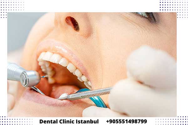implantes dentales en Turquía – El mejor médico y clínica dental de Estambul