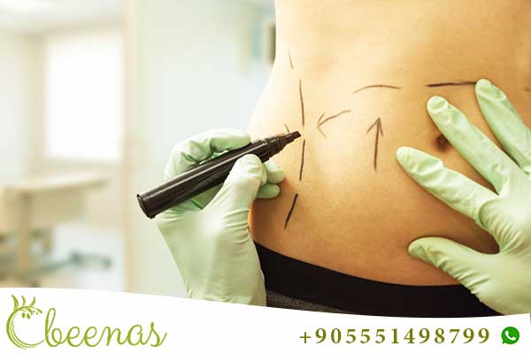 Discovering Excellence: Choosing the Best Liposuction in Turkey