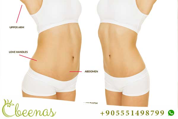 Decoding Beauty: Liposuction Prices in Istanbul