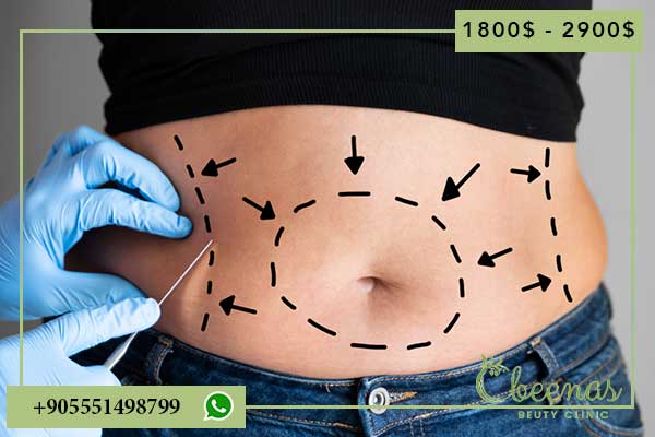 7 Key Insights into Abdominoplasty in Turkey: Experience Positive Feelings with Laviva Clinic