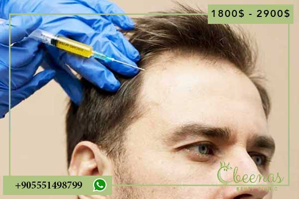 7 Reasons Why the Best Hair Plantation in Turkey Guarantees Positive Results