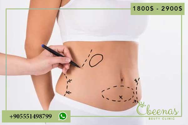 Discover the Best Place for Tummy Tuck in Turkey: 5 Positive Feelings and Comprehensive Guide