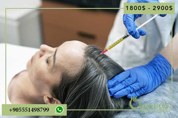 Cost Hair Transplant in Turkey: Achieve Positive Feelings with a Full Head of Hair