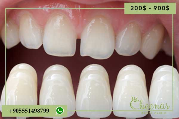 Dental Surgery Turkey: 10 Reasons to Feel Positive About Your Smile Transformation