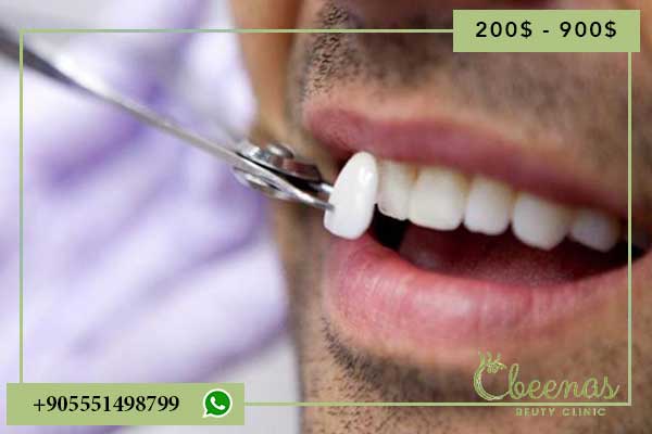 7 Positive Reasons to Choose Dental Treatment in Turkey: An Unmatched Experience