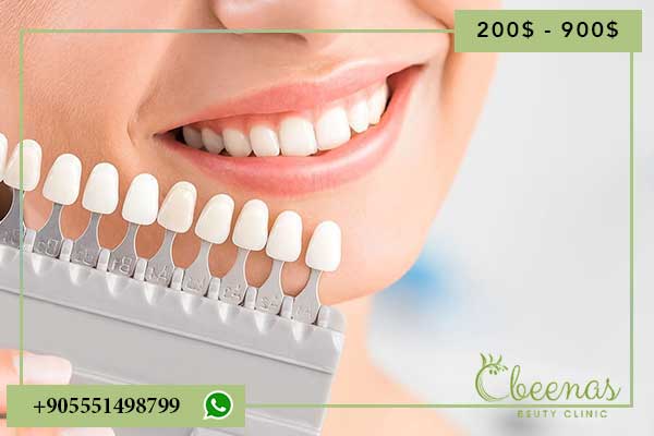 Dental Veneers Turkey: Positive Outcomes and Affordable Prices