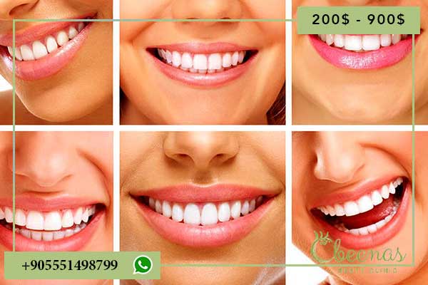 10 Reasons to Feel Positive About full mouth dental implants turkey price and Benefits