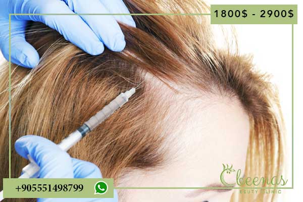 7 Positive Reasons to Consider hair implant price turkey and Benefits