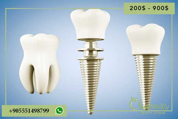 5 Positive Reasons to Choose an istanbul dental clinic turkey dentist implant crowns veneers