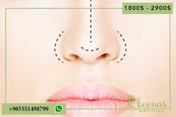 rhinoplasty turkey Best Clinics: Enhancing Your Confidence with Positive Results