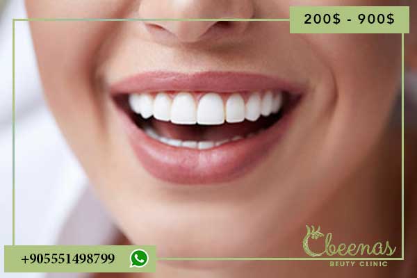 The Ultimate Guide to teeth whitening istanbul : Achieve Your Brightest Smile