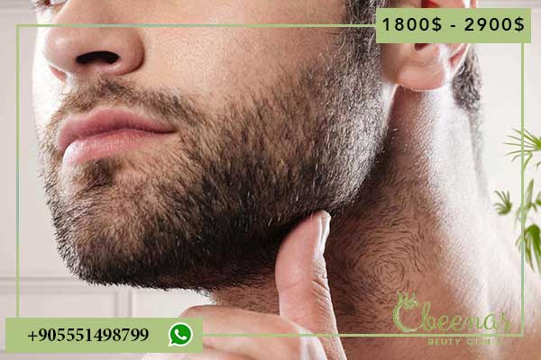 top 10 hair transplant clinic in turkey: Transforming Your Look with Positive Feelings