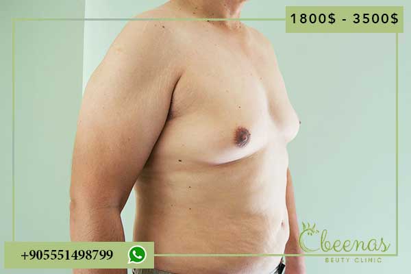 Tummy Tuck in Turkey Cost: 8 Positive Aspects to Consider