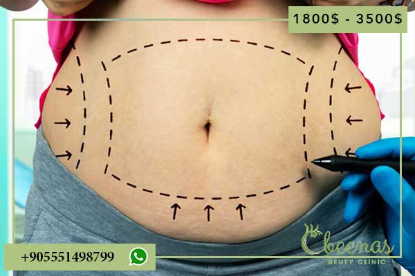 Discover Positive Changes: The Top 5 Tummy Tuck Turkey Costs Explained