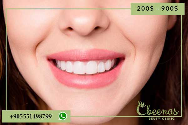 Turkey Teeth Prices: Complete Guide and Cost Comparison 2024