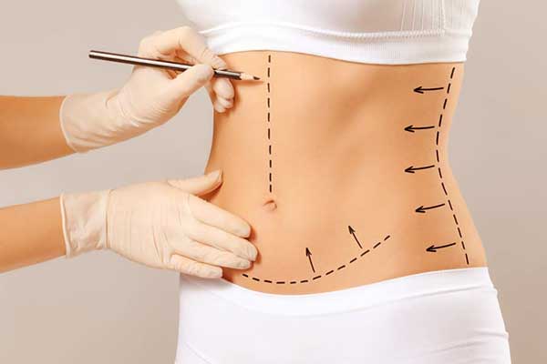 How Long Do AirSculpt Results Last? Ultimate Guide to Lasting Body Contouring