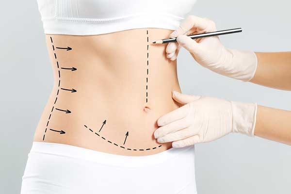 does coolsculpting tighten loose skin on stomach ? A Comprehensive Look