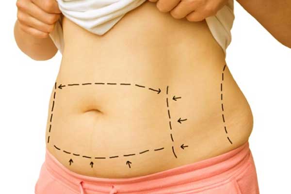 Is CoolSculpting Worth the Money? A Complete Guide to Deciding if It’s Right for You