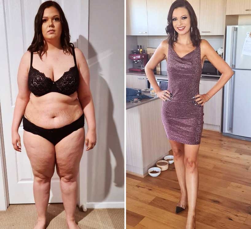 skin after coolsculpting