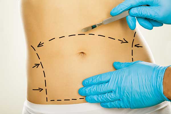 Who Should Not Get CoolSculpting? Your Guide to Knowing When to Skip This Popular Treatment