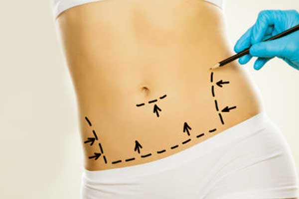 Why is My Stomach So Big After CoolSculpting? Understanding Swelling and How to Manage It