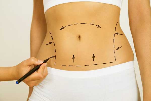 What Age Is Best for CoolSculpting? Your Ultimate Guide to Achieving Lasting Results