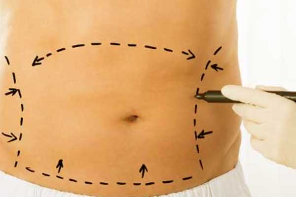 Does CoolSculpting Leave Saggy Skin? A Complete Guide to Skin Tightness and Body Contouring