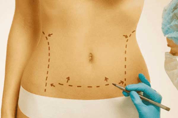 Is There Anything Better Than CoolSculpting? 5 Advanced Alternatives for Fat Reduction in 2024