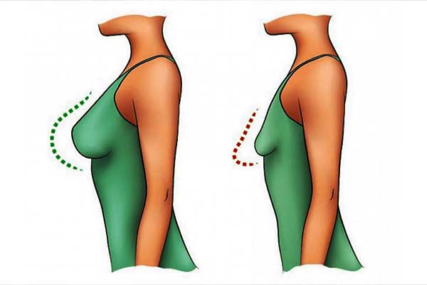 AirSculpt Gynecomastia Cost: Understanding Pricing, Procedure, and Benefits