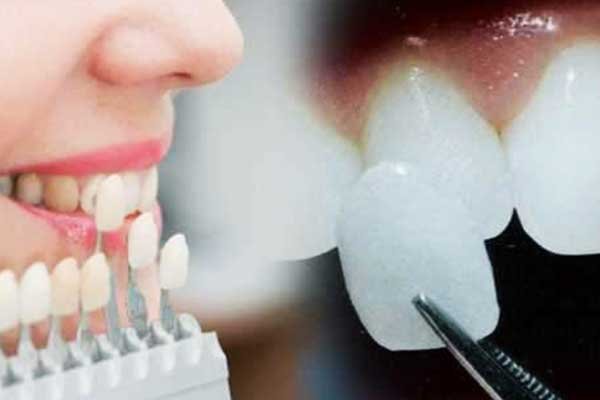 Best Dental Clinic in Turkey for Implants 2026