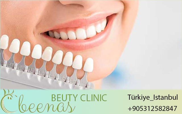 dentist in turkey 2026