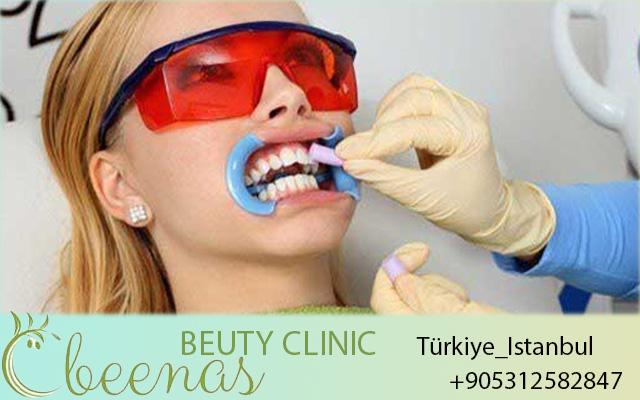 Dental Clinic in Istanbul