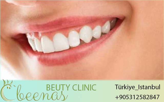 Hollywood Smile Turkey 2026